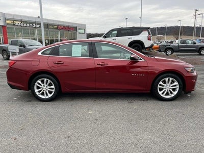 2017 Chevrolet Malibu 1LT